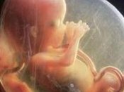 2026做第三代试管婴儿要多少钱？去泰国杰特宁医院做三代费用贵不贵？