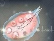 2026中山二院试管婴儿成功率一览，附试管医生推荐